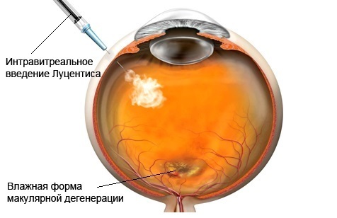 Сидите за компьютером целый день, а за зрение не боитесь? 1 Сидите за компьютером целый день, а за зрение не боитесь? 1