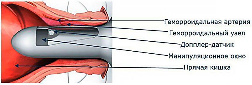 "Онли Клиник"избавит от геморроя навсегда 3 "Онли Клиник"избавит от геморроя навсегда 3