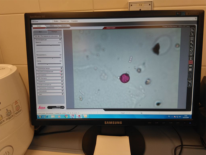 В Екатеринбурге появится уникальное оборудование в помощь аллергикам 3 В Екатеринбурге появится уникальное оборудование в помощь аллергикам 3