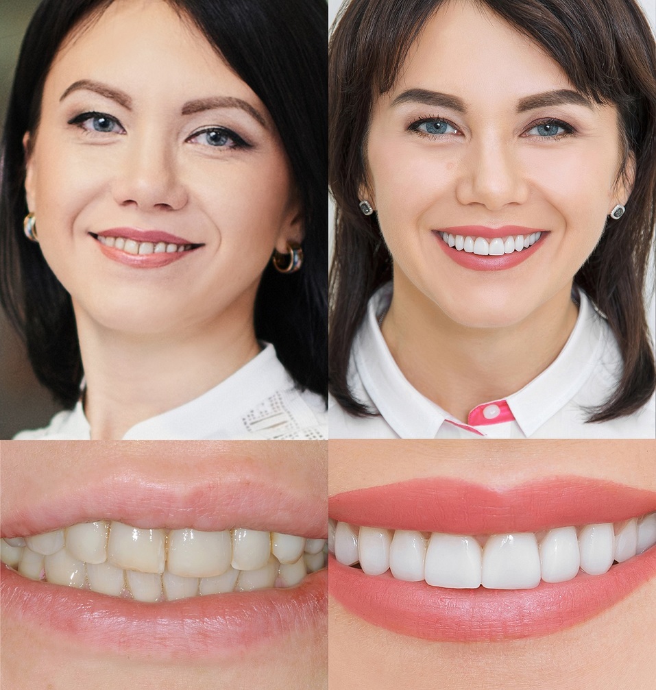 Елена Золина, пациент "Стомпрактика.рф" Елена Золина, пациент "Стомпрактика.рф"