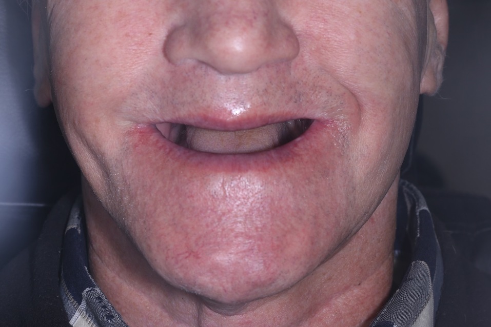 Хотите, чтобы жизнь наладилась? Займитесь своей улыбкой! 4 Хотите, чтобы жизнь наладилась? Займитесь своей улыбкой! 4