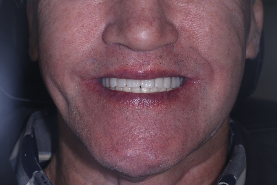 Хотите, чтобы жизнь наладилась? Займитесь своей улыбкой! 5 Хотите, чтобы жизнь наладилась? Займитесь своей улыбкой! 5