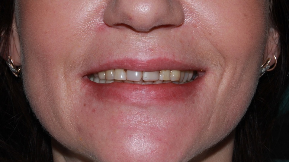 Хотите, чтобы жизнь наладилась? Займитесь своей улыбкой! 6 Хотите, чтобы жизнь наладилась? Займитесь своей улыбкой! 6