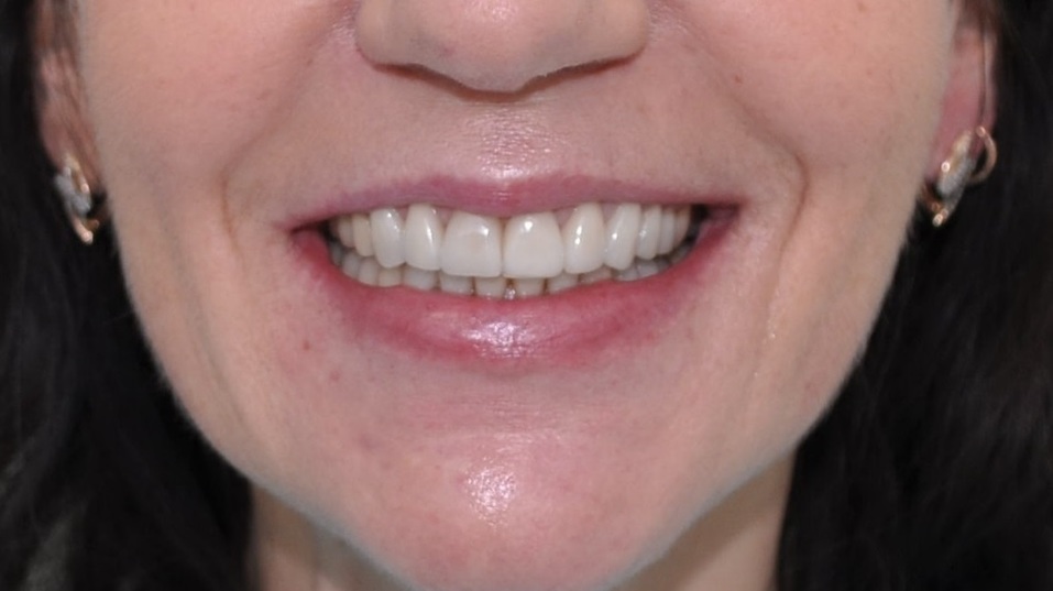 Хотите, чтобы жизнь наладилась? Займитесь своей улыбкой! 7 Хотите, чтобы жизнь наладилась? Займитесь своей улыбкой! 7