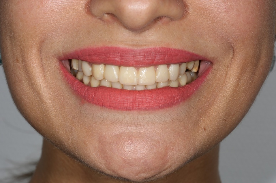 Хотите, чтобы жизнь наладилась? Займитесь своей улыбкой! 8 Хотите, чтобы жизнь наладилась? Займитесь своей улыбкой! 8