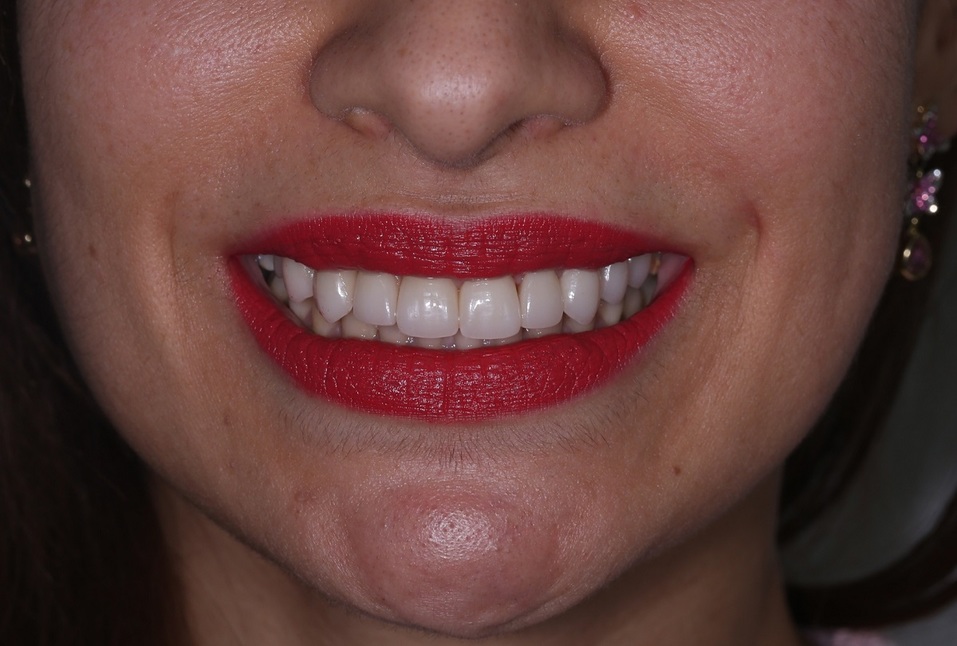 Хотите, чтобы жизнь наладилась? Займитесь своей улыбкой! 9 Хотите, чтобы жизнь наладилась? Займитесь своей улыбкой! 9