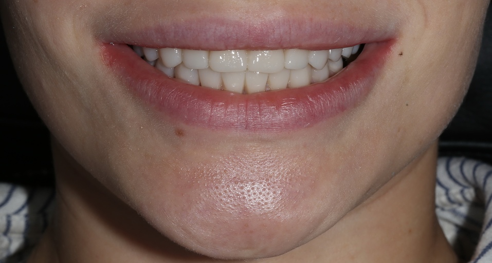 Хотите, чтобы жизнь наладилась? Займитесь своей улыбкой! 11 Хотите, чтобы жизнь наладилась? Займитесь своей улыбкой! 11