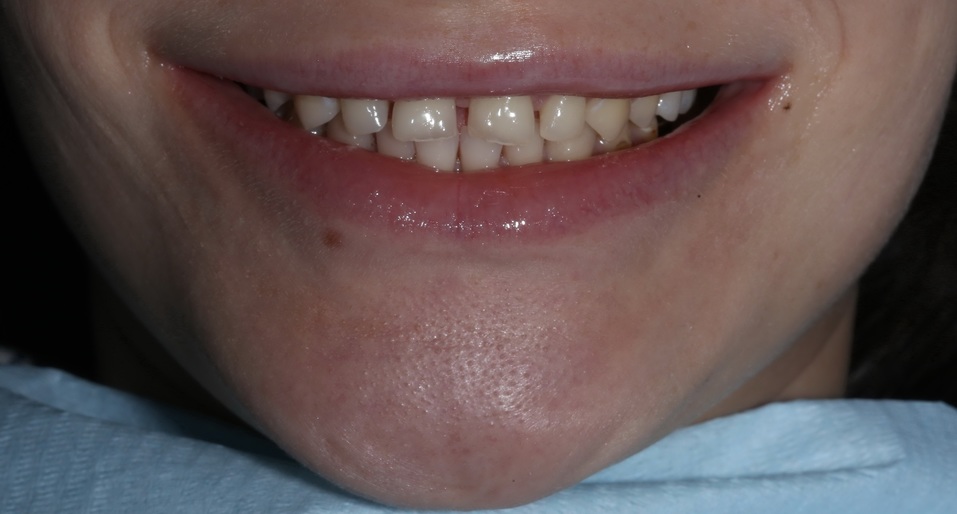 Хотите, чтобы жизнь наладилась? Займитесь своей улыбкой! 10 Хотите, чтобы жизнь наладилась? Займитесь своей улыбкой! 10