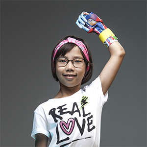 Как российская компания научилась делать роботизированные протезы для детей и взрослых
3 Как российская компания научилась делать роботизированные протезы для детей и взрослых
3