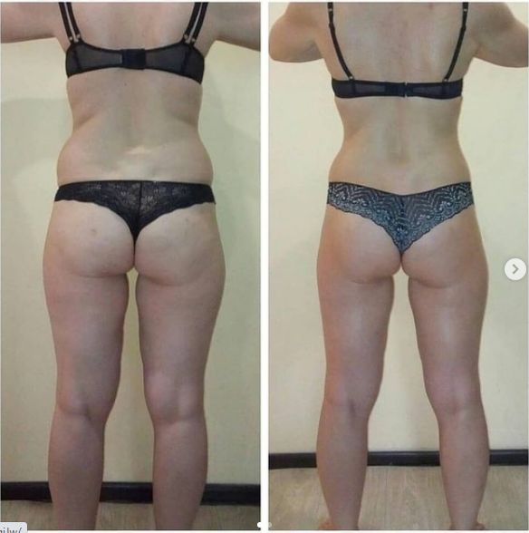 Результат массажа тела Результат массажа тела