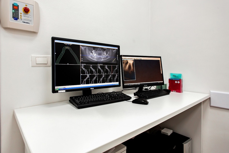 Прозрачная альтернатива: брекеты — не единственный путь к ровной улыбке 6 Прозрачная альтернатива: брекеты — не единственный путь к ровной улыбке 6