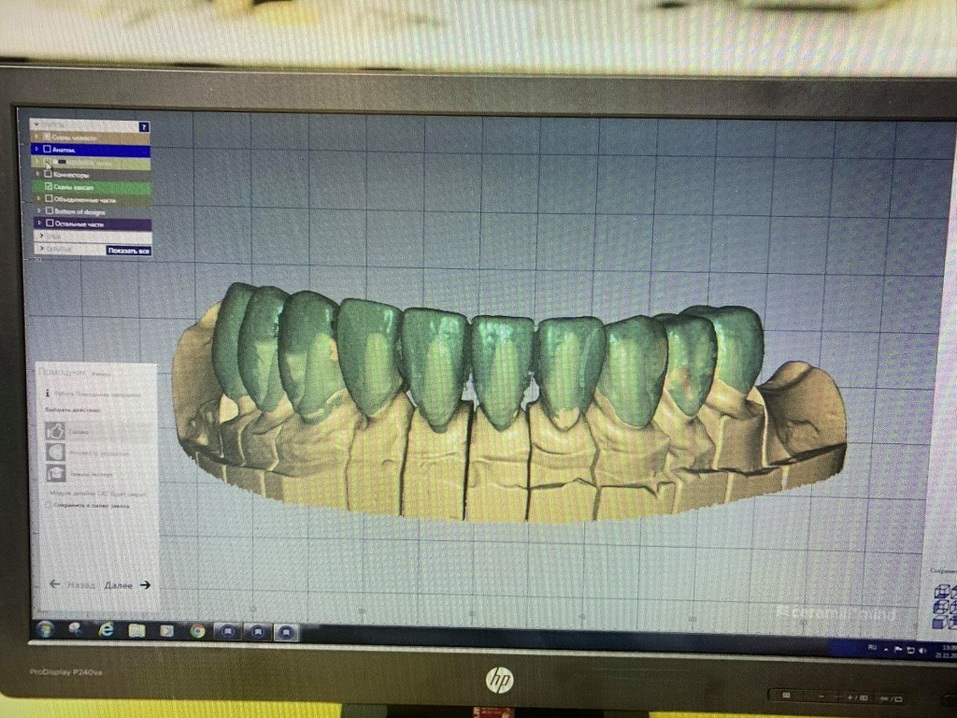Академия VIP: «Совершенная улыбка — результат высоких технологий и работа профессионалов» 2 Академия VIP: «Совершенная улыбка — результат высоких технологий и работа профессионалов» 2