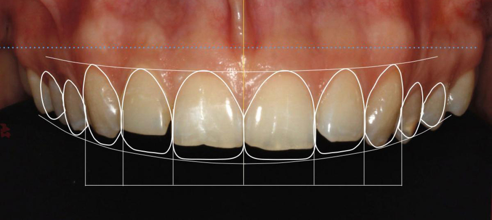 Академия VIP: «Цифровые технологии вывели стоматологию на новый уровень» 1 Академия VIP: «Цифровые технологии вывели стоматологию на новый уровень» 1