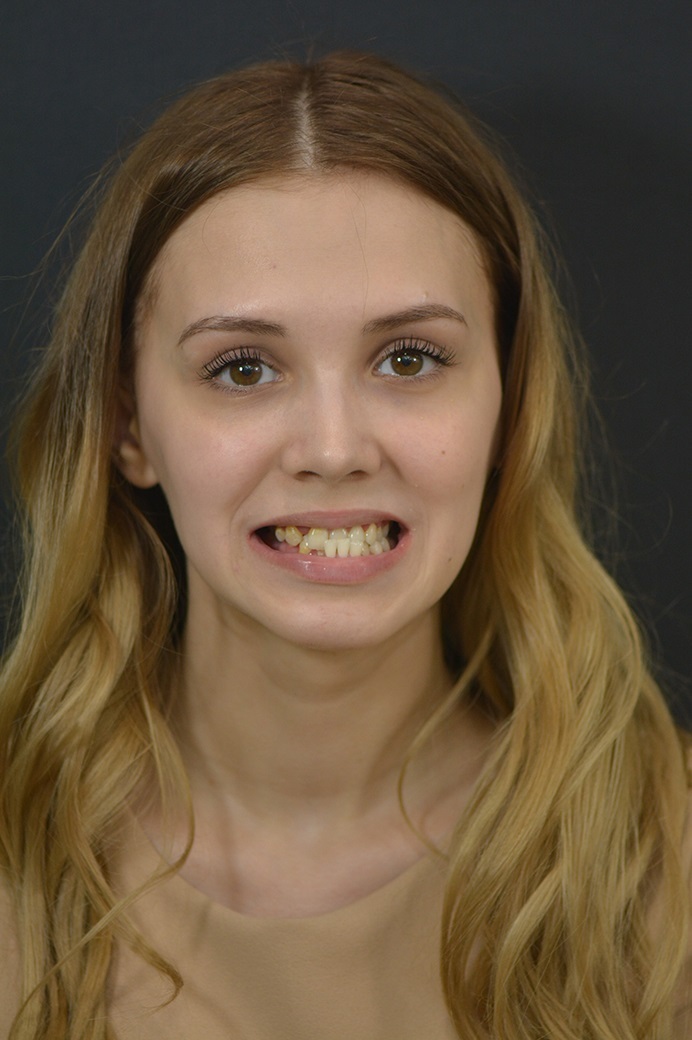 Как ортодонты меняют наши жизни: волшебство в стенах клиники «ОК» 1 Как ортодонты меняют наши жизни: волшебство в стенах клиники «ОК» 1