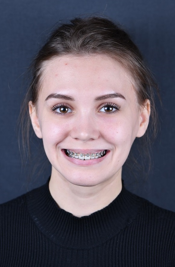 Как ортодонты меняют наши жизни: волшебство в стенах клиники «ОК» 2 Как ортодонты меняют наши жизни: волшебство в стенах клиники «ОК» 2