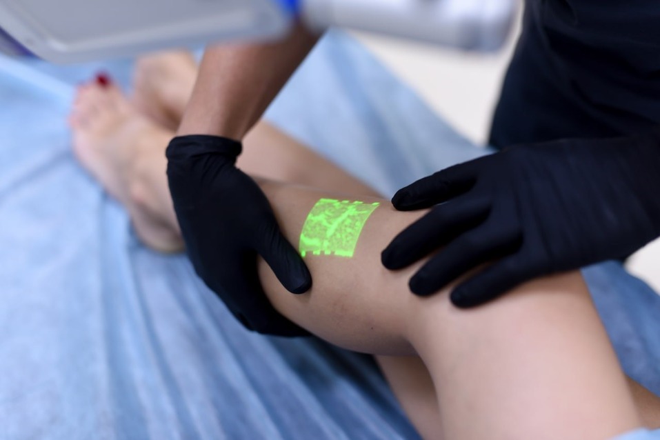 «Венозная Эстетическая Хирургия»: развиваем флебологию в России 5 «Венозная Эстетическая Хирургия»: развиваем флебологию в России 5