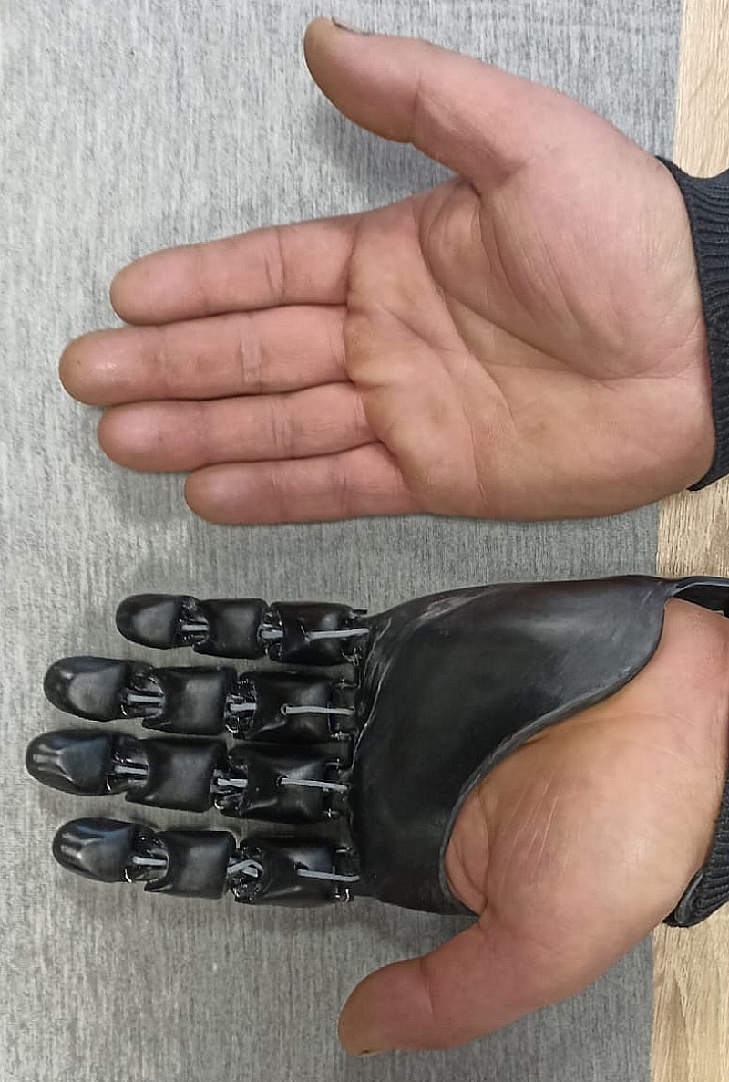 «Квалитет»: ветеранам СВО готовы делать протезы бесплатно 1 «Квалитет»: ветеранам СВО готовы делать протезы бесплатно 1