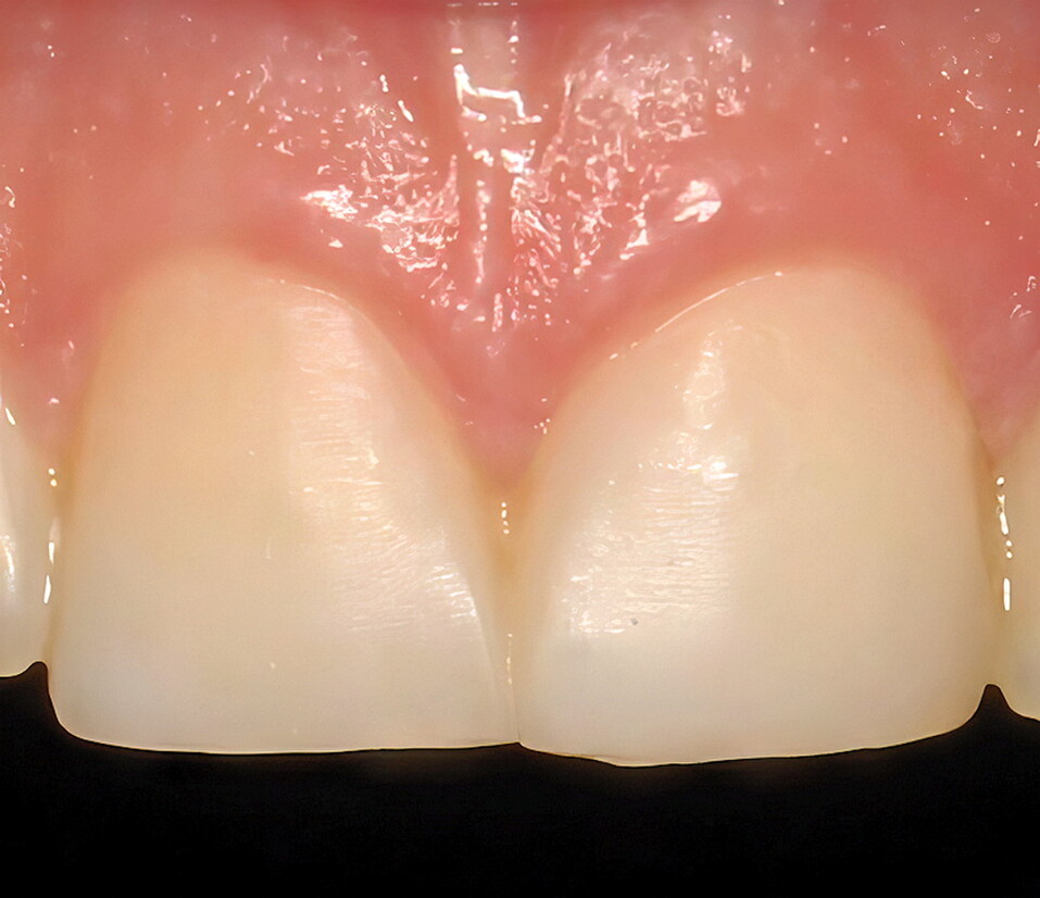 Искусство реставрации, или детали решают все 1 Искусство реставрации, или детали решают все 1