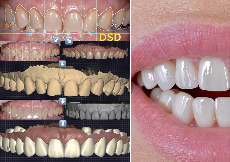 Умная стоматология: высокие технологии для безупречной улыбки 3 Умная стоматология: высокие технологии для безупречной улыбки 3