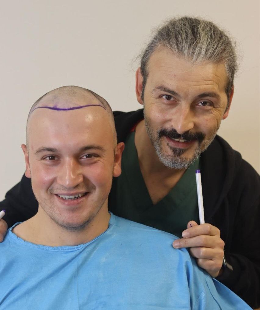 Новый уровень пересадки волос: челябинцам стали доступны мировые технологии 7 Новый уровень пересадки волос: челябинцам стали доступны мировые технологии 7