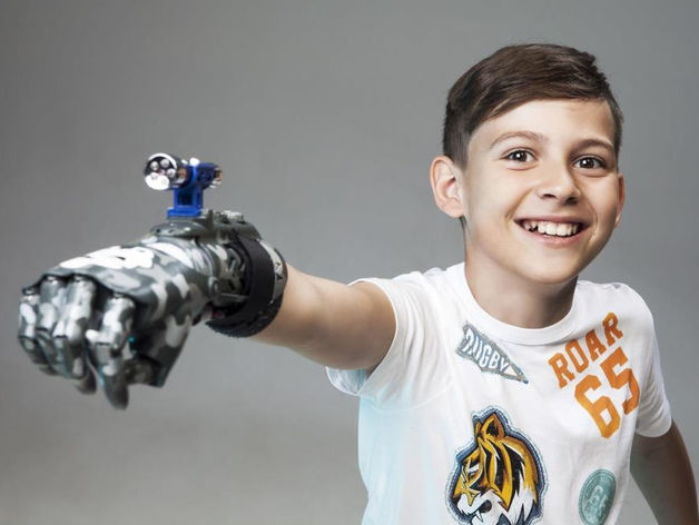 Как российская компания научилась делать роботизированные протезы для детей и взрослых